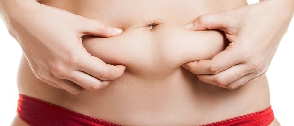 Abdominoplastia: a queridinha do momento