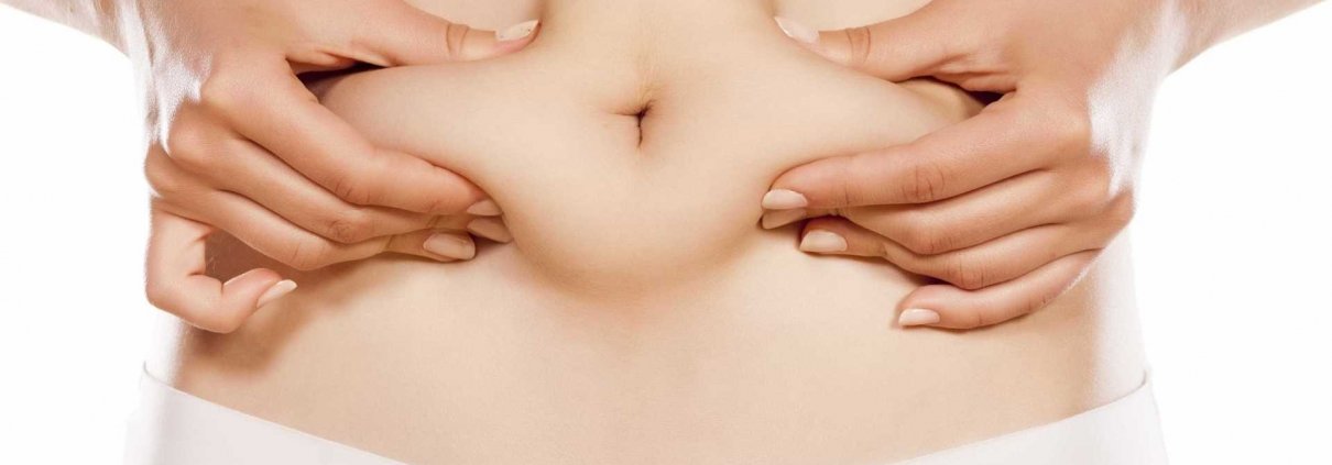 Miniabdominoplastia
