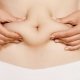 Miniabdominoplastia