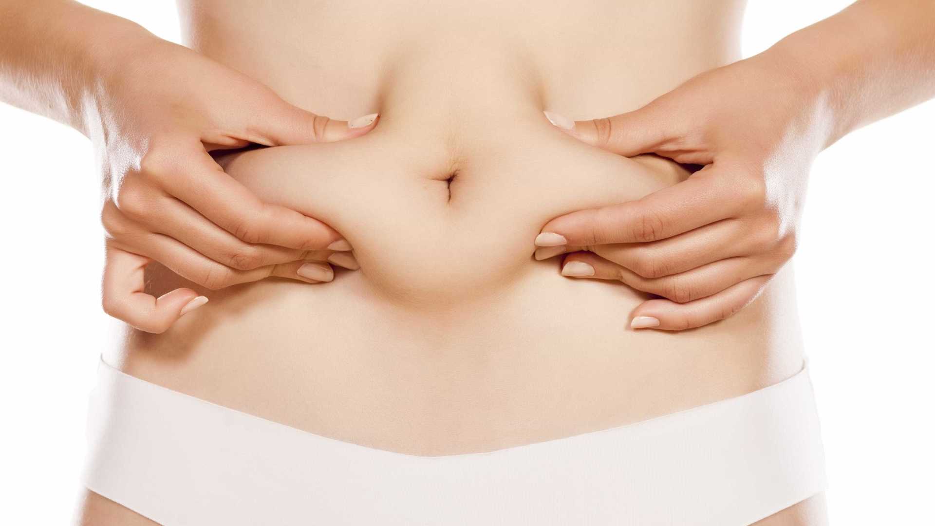 Miniabdominoplastia