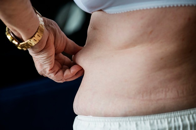 Abdominoplastia na terceira idade