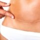 Como cuidar da cicatriz da abdominoplastia